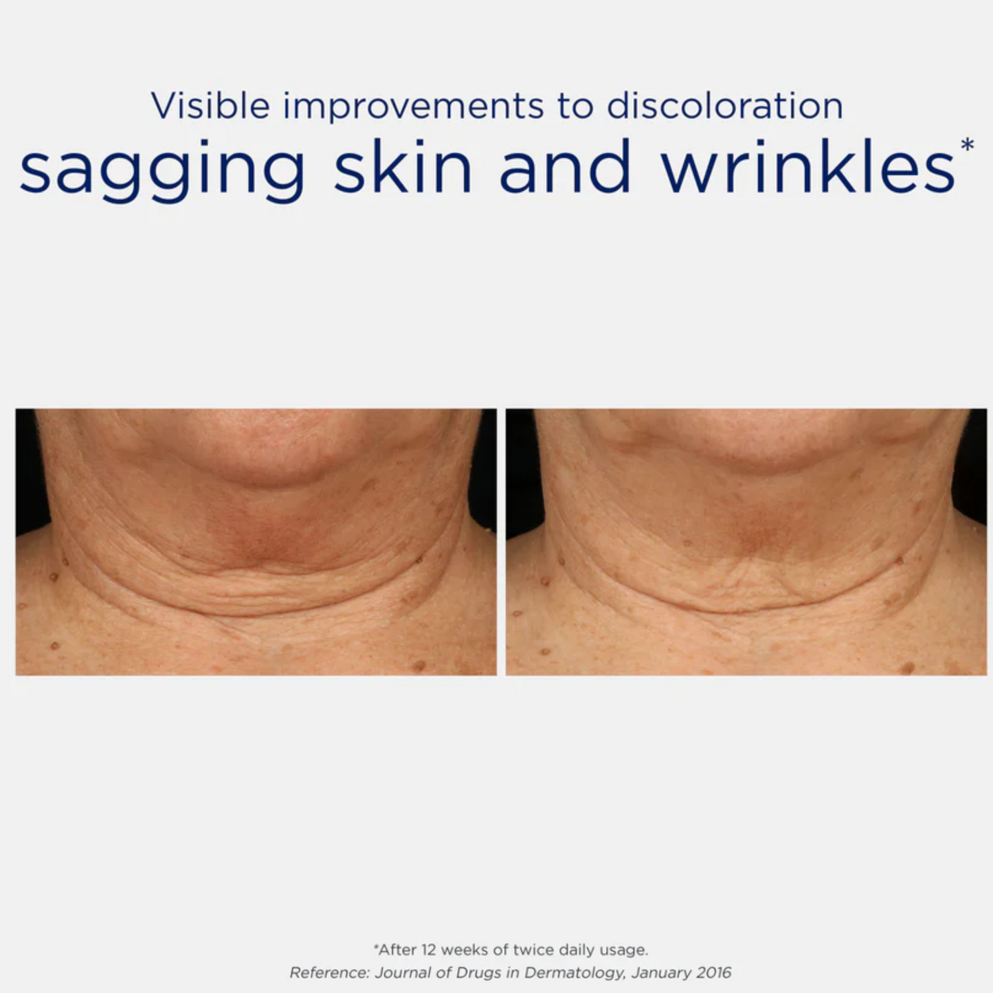Triple Firming Neck Cream With MicroDiPeptide229®